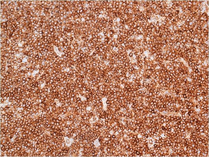 Figure 8b. CD123, 20x